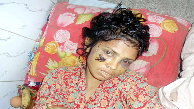 Tortured by husband woman fights for life