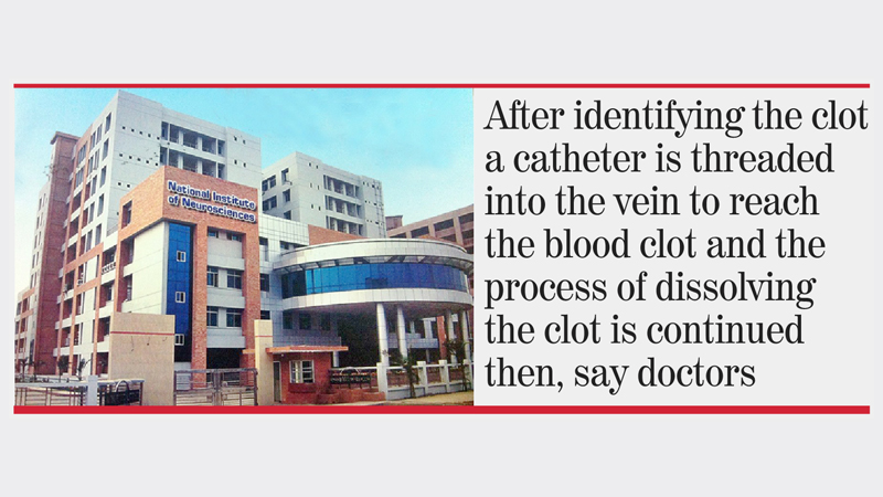 ‘Surgery no longer needed for treating stroke’